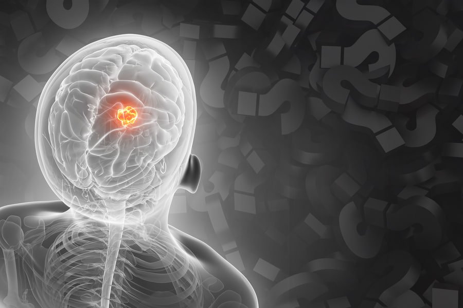 Olimlar saratonni sun’iy intellekt yordamida davolashning yangi usulini kashf etdi